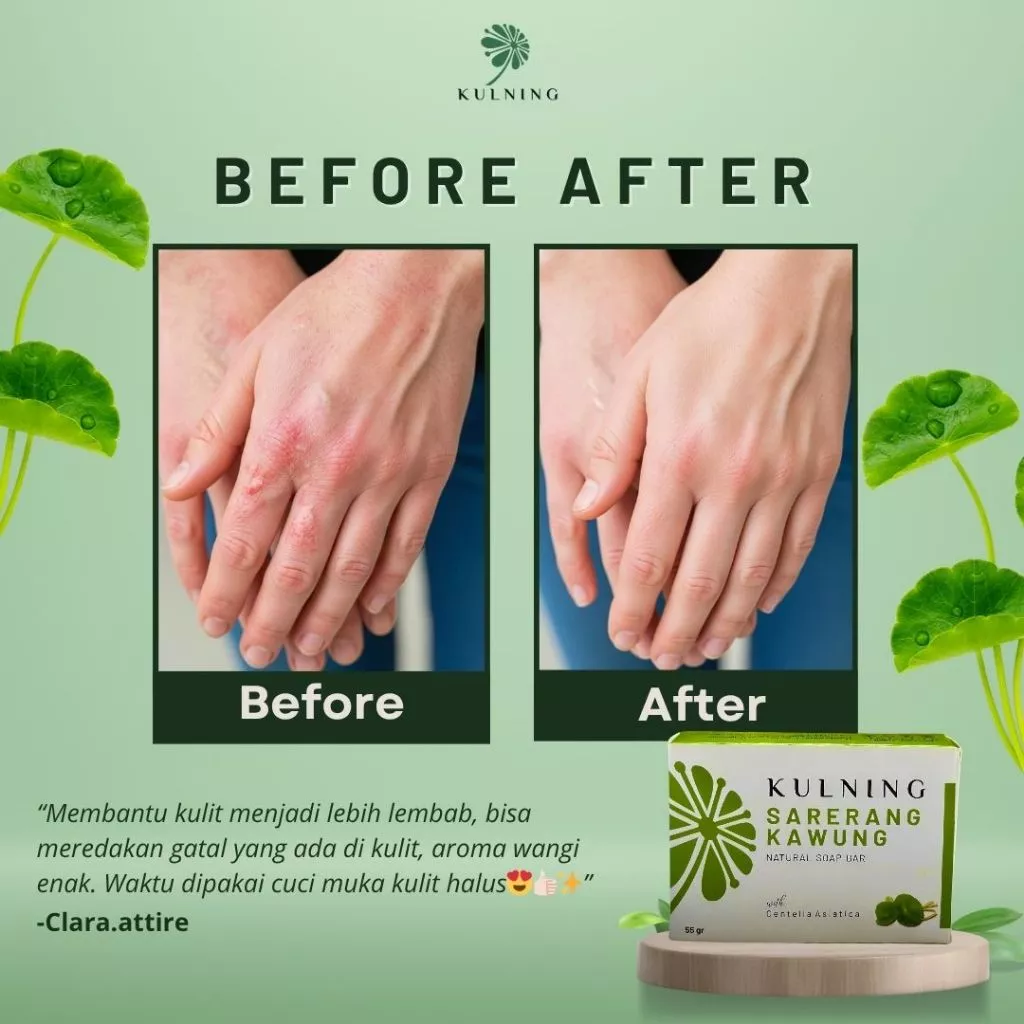 Kulning Sabun Sarerang Kawung Hijau - Gambar 2