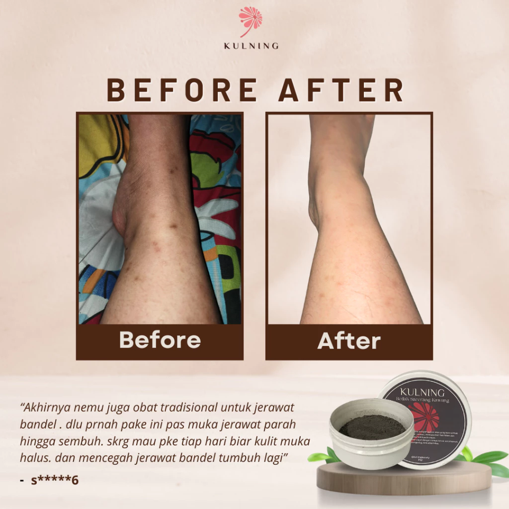 Bedak Kulning Sarerang Kawung - Gambar 2